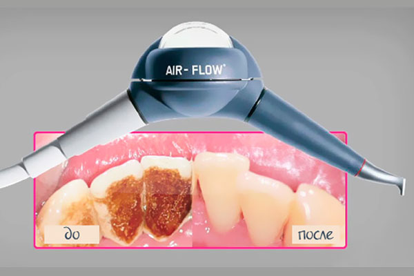 Технология AIR FLOW Технология AIR FLOW